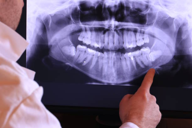 Best Urgent Tooth Repair  in Keowee Key, SC